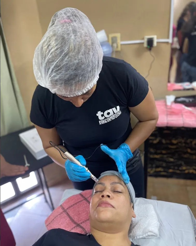 Práctica de microneedling en taller de estética TAV